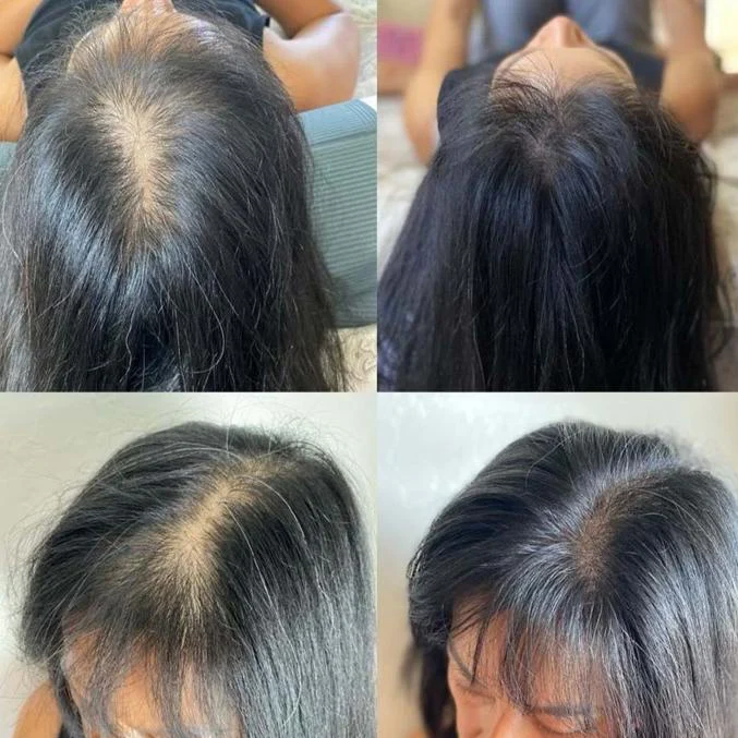 Hair Fall Control collection
