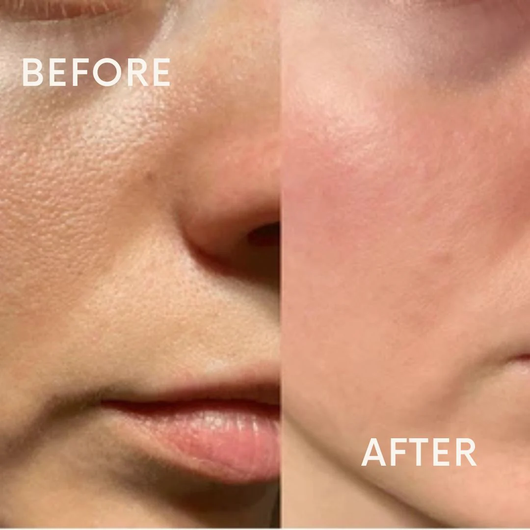 Open Pores & Dull Face Treatment Combo Kit | All Skin Types thumbnail 3