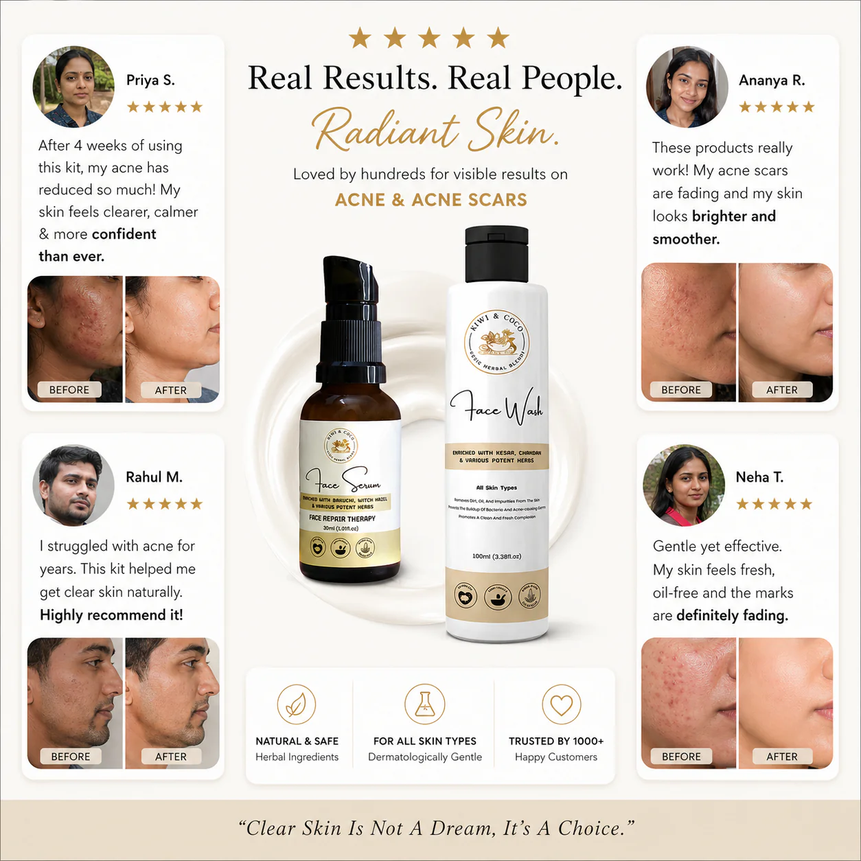 Acne & Acne Scar Management Combo Kit thumbnail 4